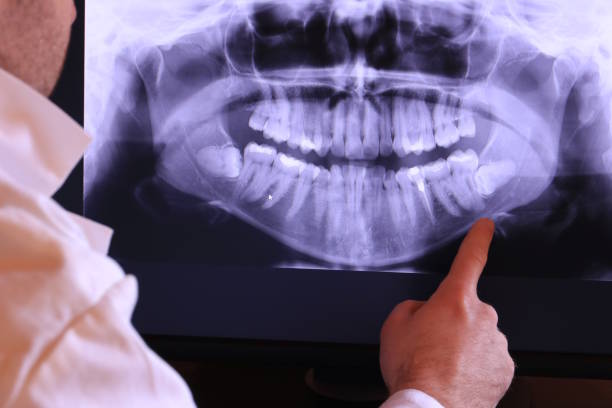 Best Same-Day Emergency Dental Services in Vaughn, WA