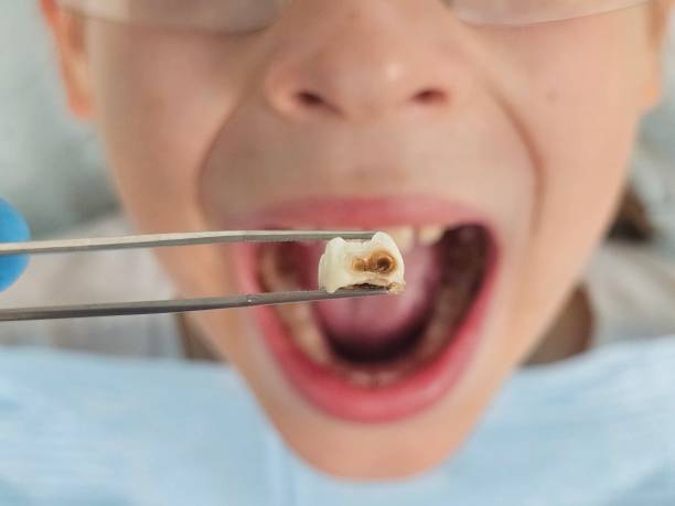 Best After-Hours Dental Trauma Care in Vaughn, WA
